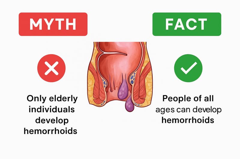 Myths vs. Facts: Clearing Up Common Misconceptions About Piles